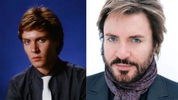 Has Simon Le Bon Had Plastic Surgery?: Who Is Simon Le Bon?