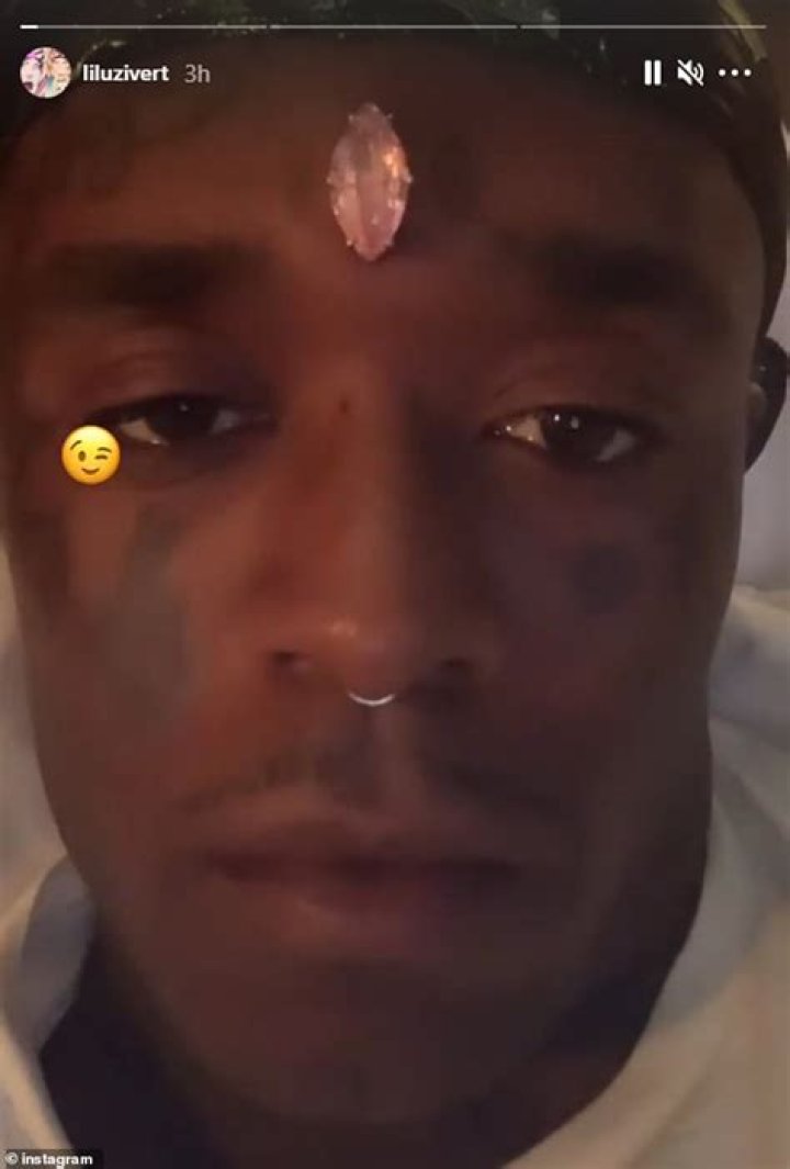 “If I Don’t Remove It, I Could Die”- Rapper, Lil Uzi Vert Cries Out After Implanting $24m Diamond In His Forehead