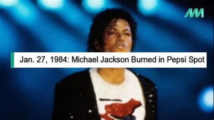 Michael Jackson Burned in Pepsi Spot